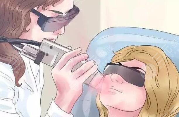 激光嫩膚一般多少錢做一次？激光嫩膚具體作用有哪些？