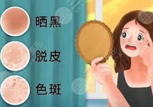 臉上的色斑怎么去掉(淡化)？