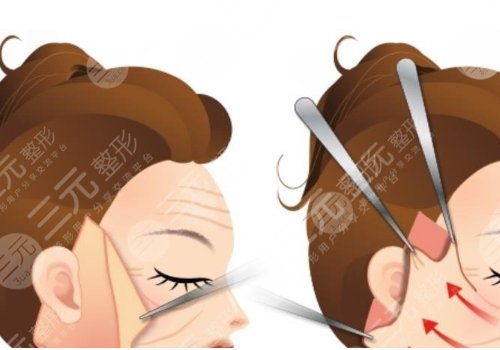 拉皮手術(shù)多大年齡做合適？