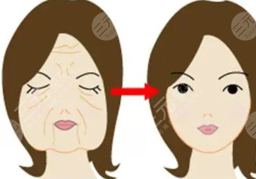面部緊致的方法有哪些？