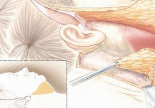 面部緊致的方法有哪些？