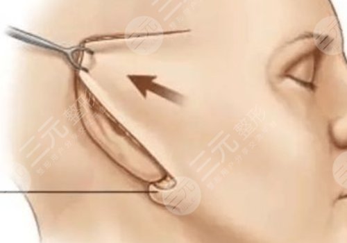 面部緊致的方法有哪些？