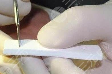 膨體隆鼻如何護(hù)理?