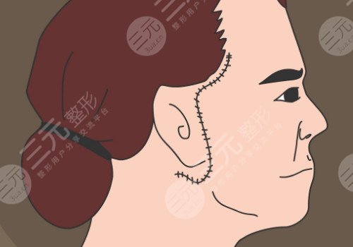 多維除皺真的有用嗎？