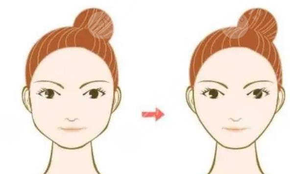 磨骨瘦臉多少費用