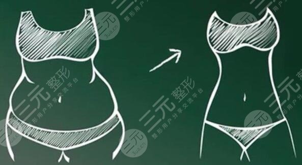 光纖溶脂是怎么做的？有哪些優(yōu)勢？術(shù)后護理事項怎么做？