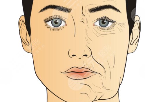 深藍射頻間隔多久做一次？