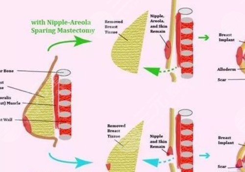 王愛(ài)武整形醫(yī)師醫(yī)術(shù)怎么樣？