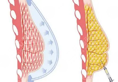 王愛(ài)武整形醫(yī)師醫(yī)術(shù)怎么樣？