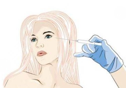 注射除皺眼部效果好嗎？