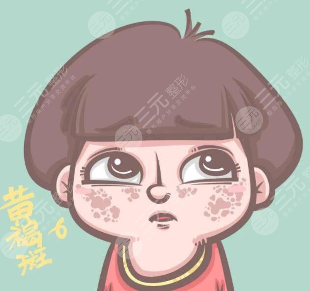 醫(yī)美激光祛除黃褐斑原理是什么?