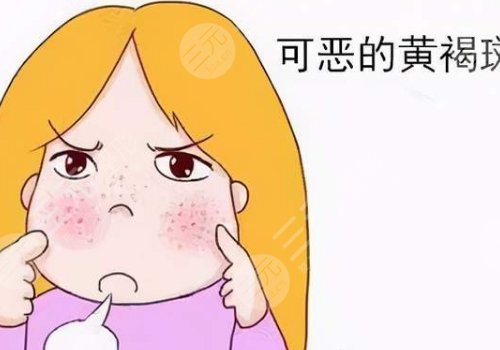 激光祛斑會不會反彈？