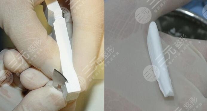 膨體隆鼻感染的癥狀是什么?