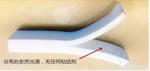 膨體隆鼻預(yù)防感染注意事項有哪些?