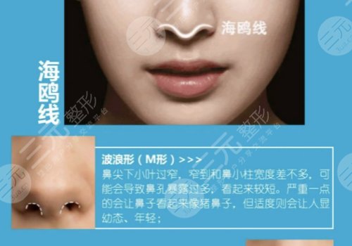 海鷗線和鷹鉤鼻的區(qū)別