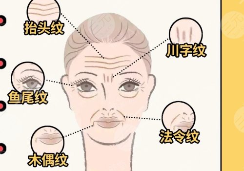 超聲炮單個(gè)炮頭要打多少發(fā)？