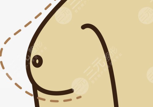 隆胸乳暈切口的優(yōu)缺點(diǎn)