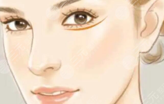 墊鼻梁有什么后遺癥和風(fēng)險(xiǎn)？要盡量避免文中4種癥狀，否則修復(fù)！