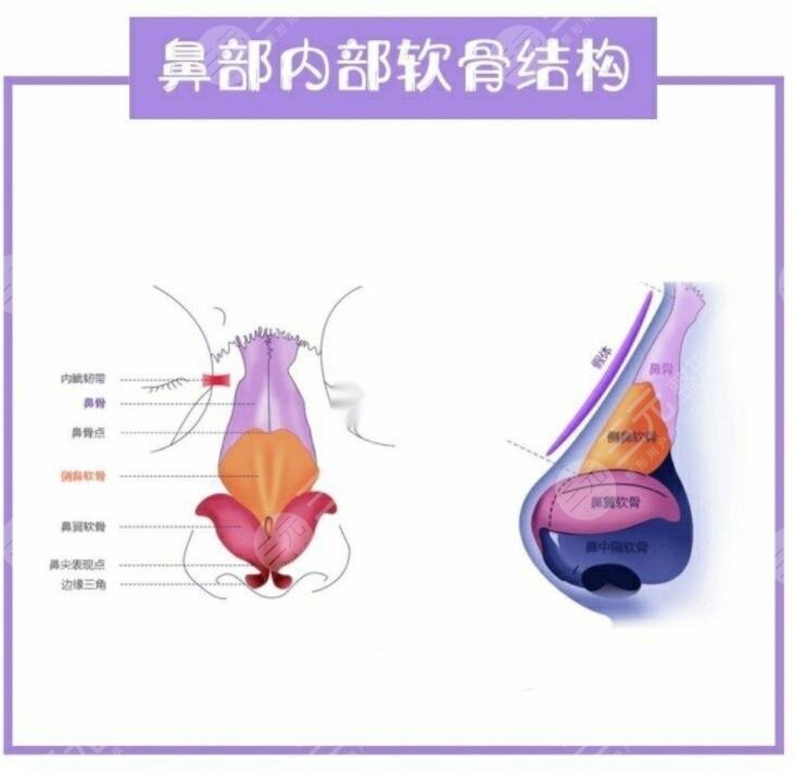 墊鼻梁有什么后遺癥和風(fēng)險(xiǎn)?