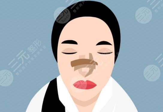 假體隆鼻怎樣去進(jìn)行護(hù)理?