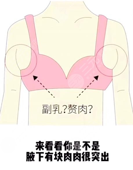 6大腋下副乳運(yùn)動(dòng)消除方法！4分鐘消除副乳！甩掉拜拜肉！