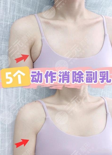 腋下副乳運(yùn)動(dòng)消除方法