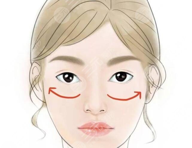 蘋果肌復(fù)位
