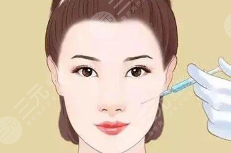 蘋果肌復(fù)位