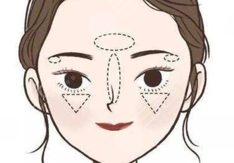 蘋果肌復(fù)位