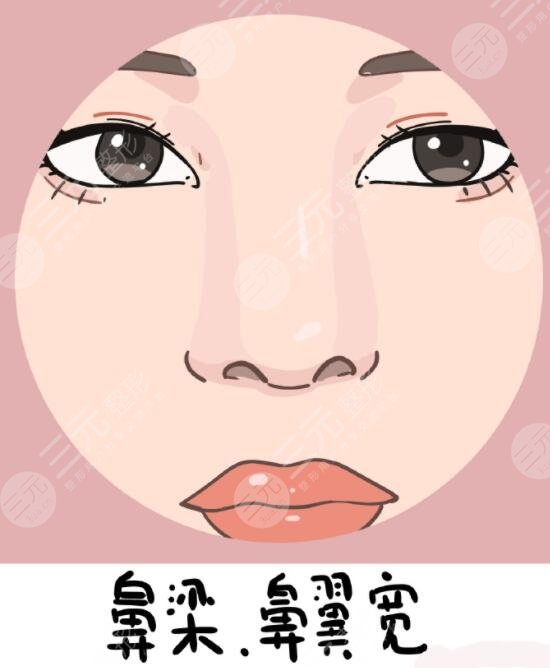 硅膠隆鼻前后對(duì)比效果差距明顯，直男看了都直呼‘側(cè)顏殺手’