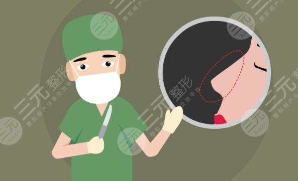 硅膠隆鼻前后對(duì)比效果差距明顯，直男看了都直呼‘側(cè)顏殺手’