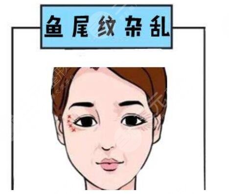 祛除魚(yú)尾紋的注意事項(xiàng)