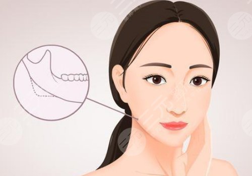 輪廓整形1個月和6個月對比圖