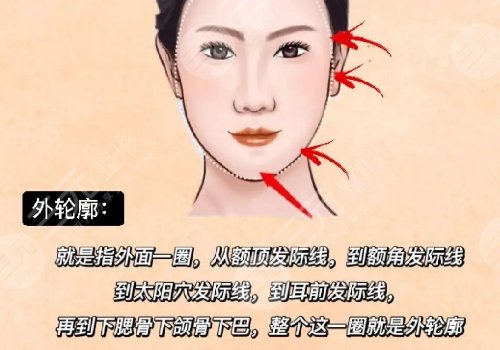 輪廓整形1個月和6個月對比圖