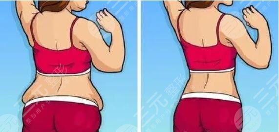 瘦腰豐胸運(yùn)動(dòng)有用嗎？常見(jiàn)的安全可靠的豐胸運(yùn)動(dòng)盤點(diǎn)！