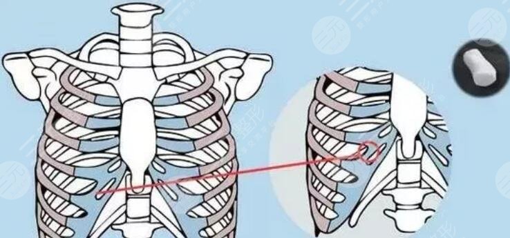 寧波郭光燁醫(yī)生擅長(zhǎng)項(xiàng)目