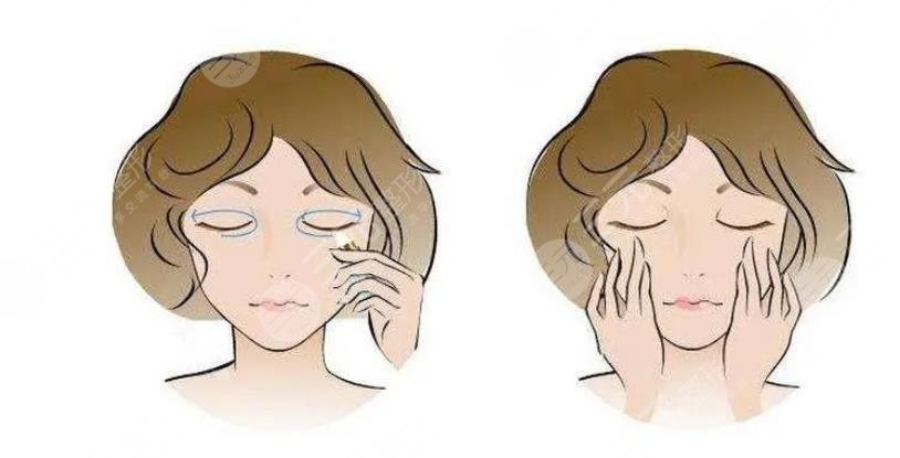 外切眼袋一般要多久才能完全恢復(fù)