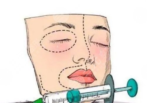 面部脂肪填充多久能恢復(fù)自然？