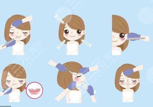 微調(diào)整形有風(fēng)險(xiǎn)嗎？