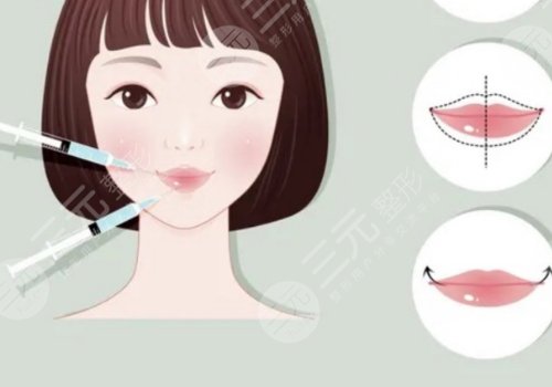 微調(diào)整形有風(fēng)險(xiǎn)嗎？