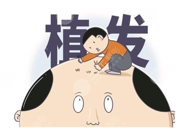 種一根頭發(fā)需要多少錢