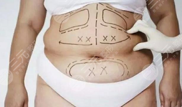 仰臥起坐能減肚子嗎