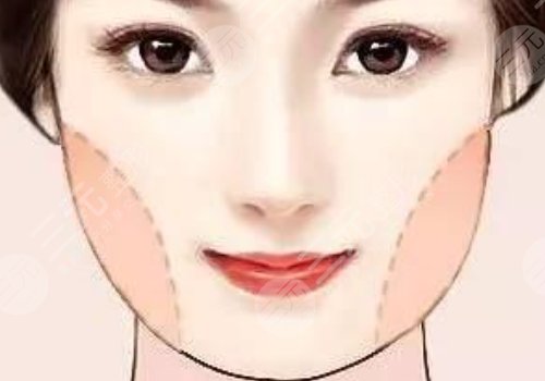 國字臉削骨手術(shù)風(fēng)險(xiǎn)大嗎？