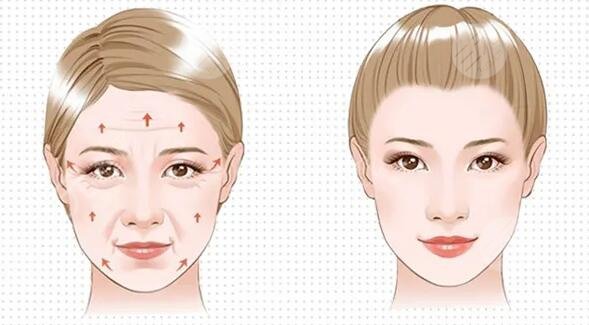 手術(shù)方式的選擇