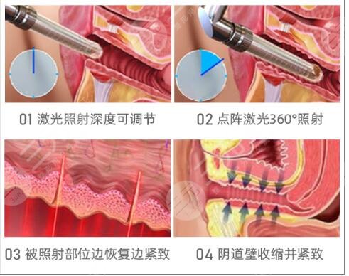 手術(shù)緊縮術(shù)具備哪些禁忌癥?