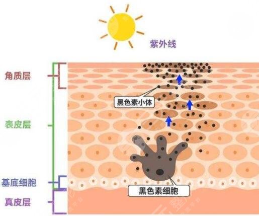 祛斑的方法以及注意事項(xiàng)