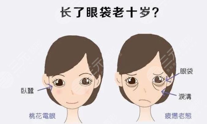 內(nèi)切眼袋多久能夠恢復(fù)正常