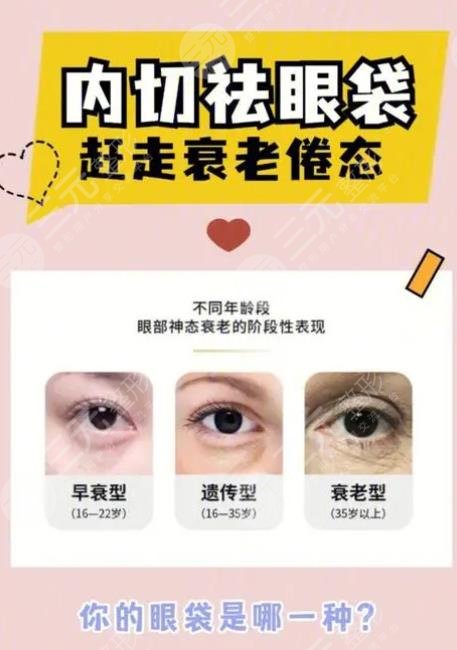 內(nèi)切眼袋多久能夠恢復(fù)正常