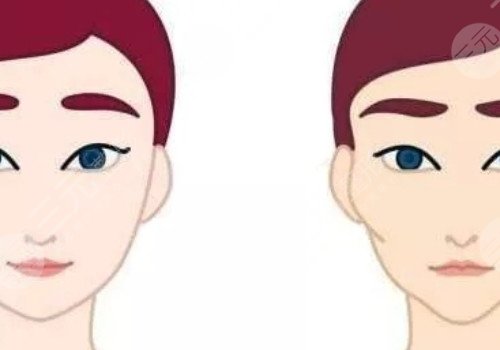 籍建華輪廓多少錢啊?