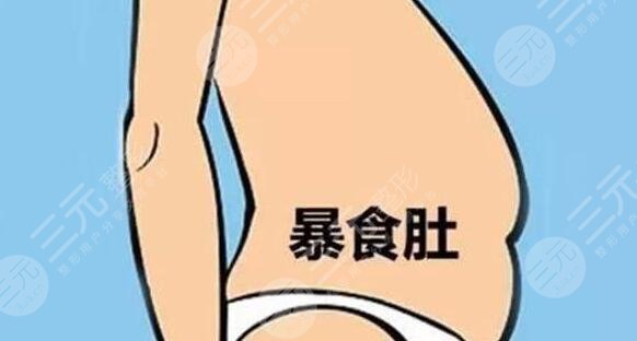 清腸胃減肥法有哪些?